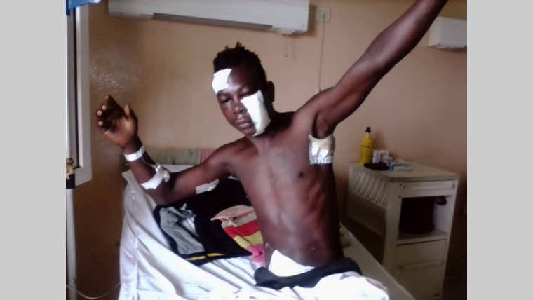 Lastoursville : un exploitant d'or agressé à la machette