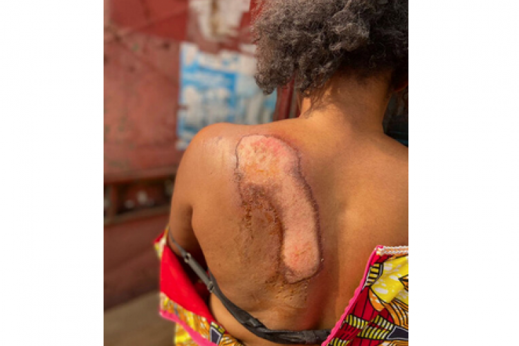 L'artiste Teellayna la Gaboma échappe à un kidnapping